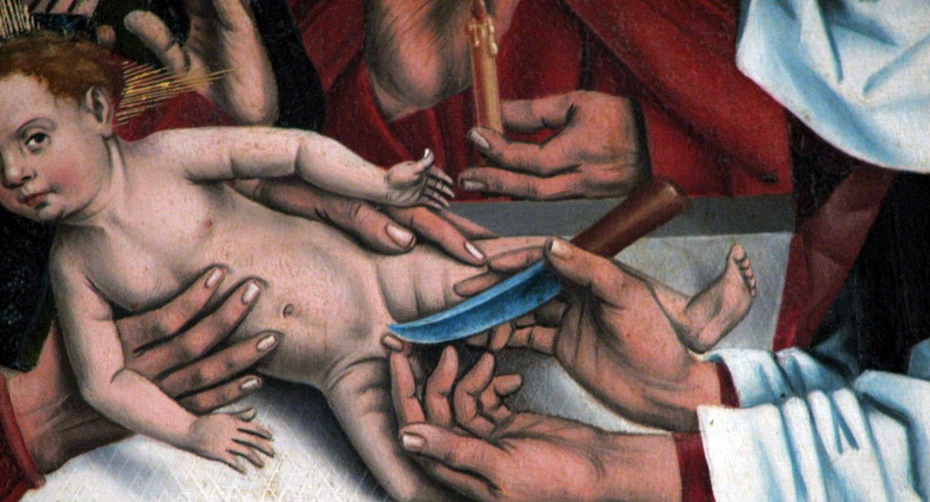 The circumcision of Jesus.